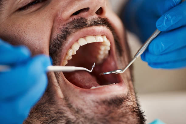 Best Walk-In Emergency Dental Services in Mercer, PA